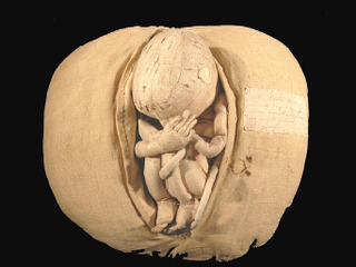 Illustration for article titled Check Out This Crazy Fabric Womb From the 18th Century